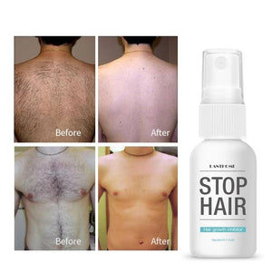 Stop Hair Serum